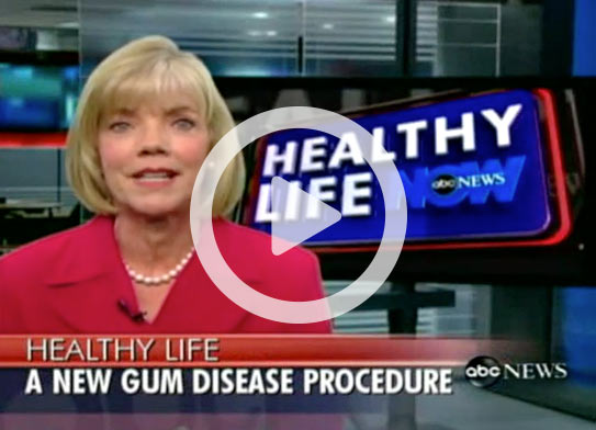 ABC News Segment