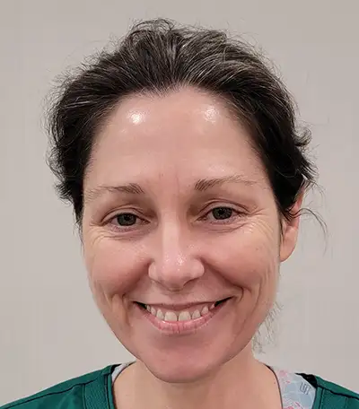 Patient Smiling before receiving BOTOX